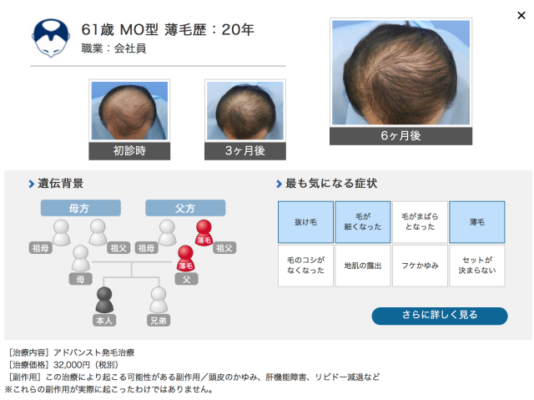 ヘアメディカル 公式サイト参照