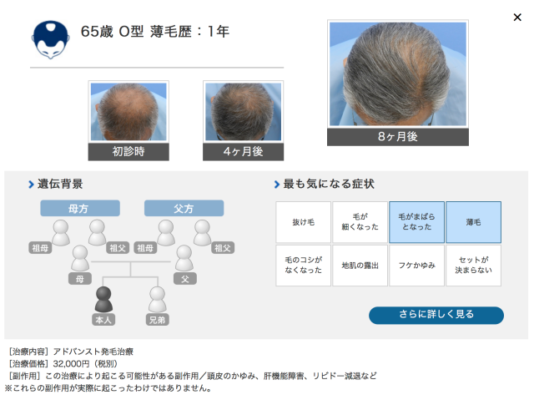 ヘアメディカル 公式サイト参照