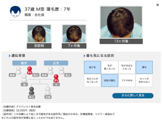 ヘアメディカル 公式サイト参照