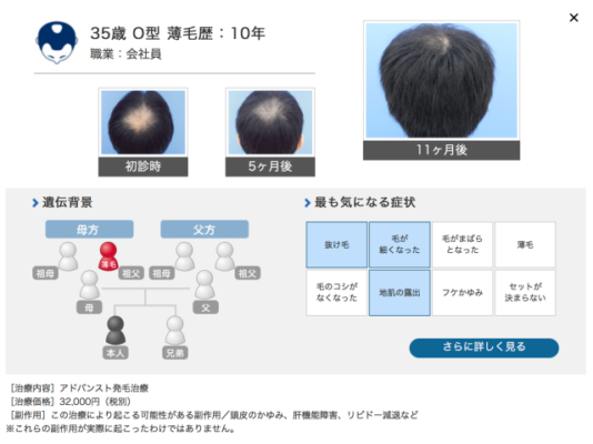 ヘアメディカル 公式サイト参照