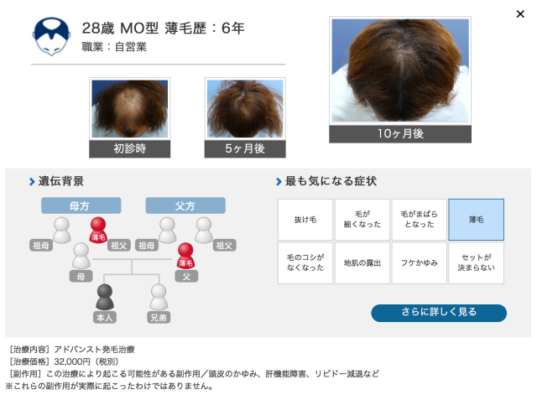 ヘアメディカル 公式サイト参照