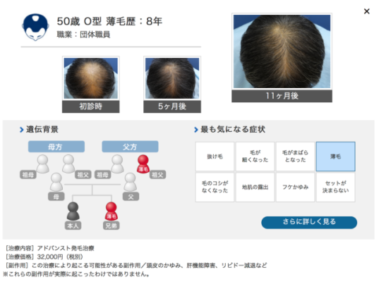 ヘアメディカル 公式サイト参照