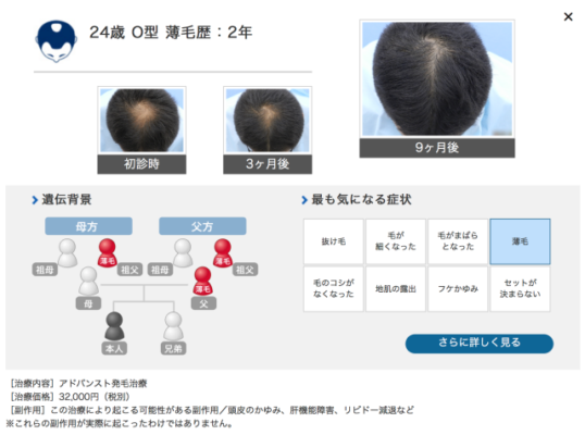 ヘアメディカル 公式サイト参照